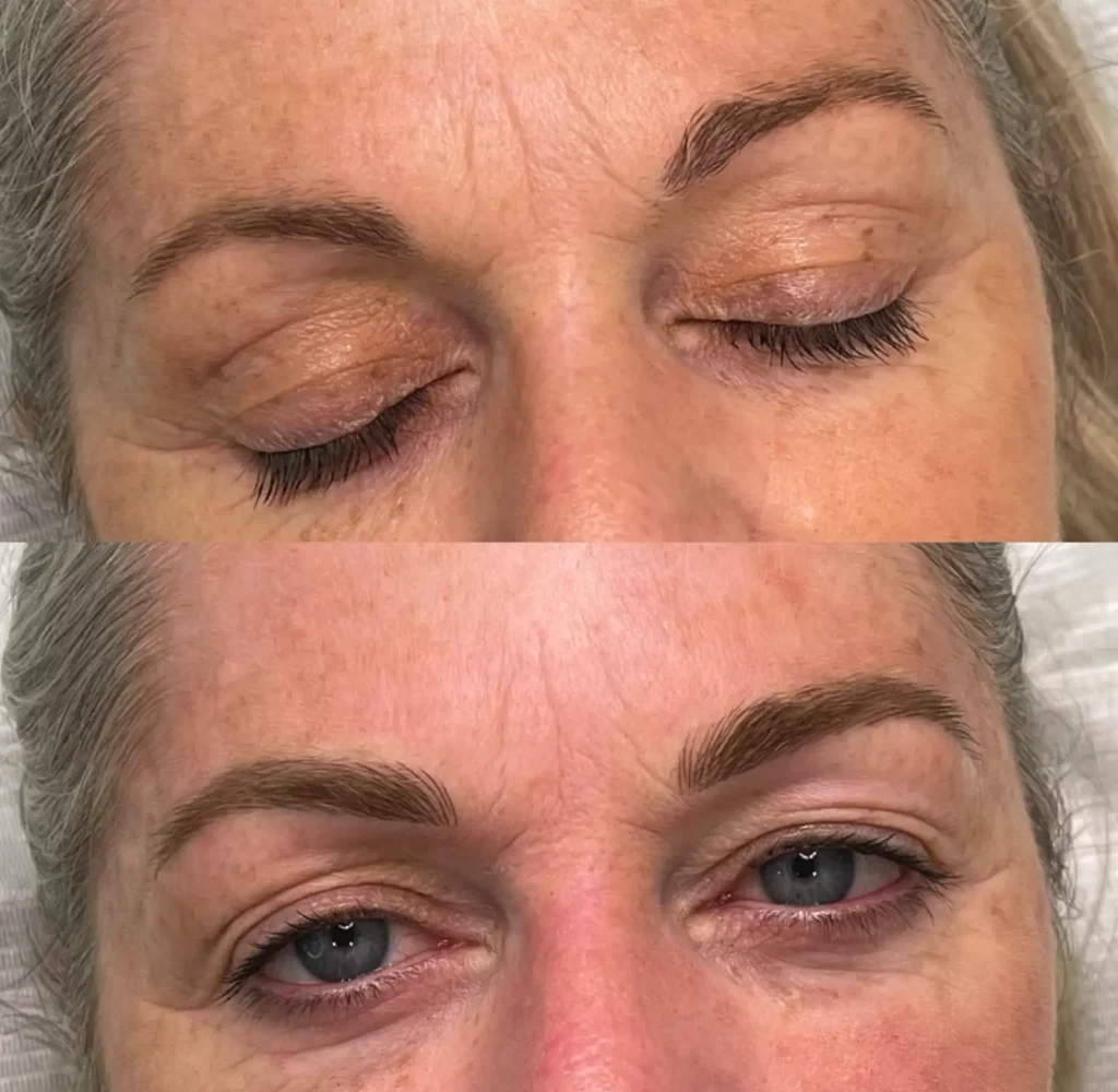 cosmetic tattooing