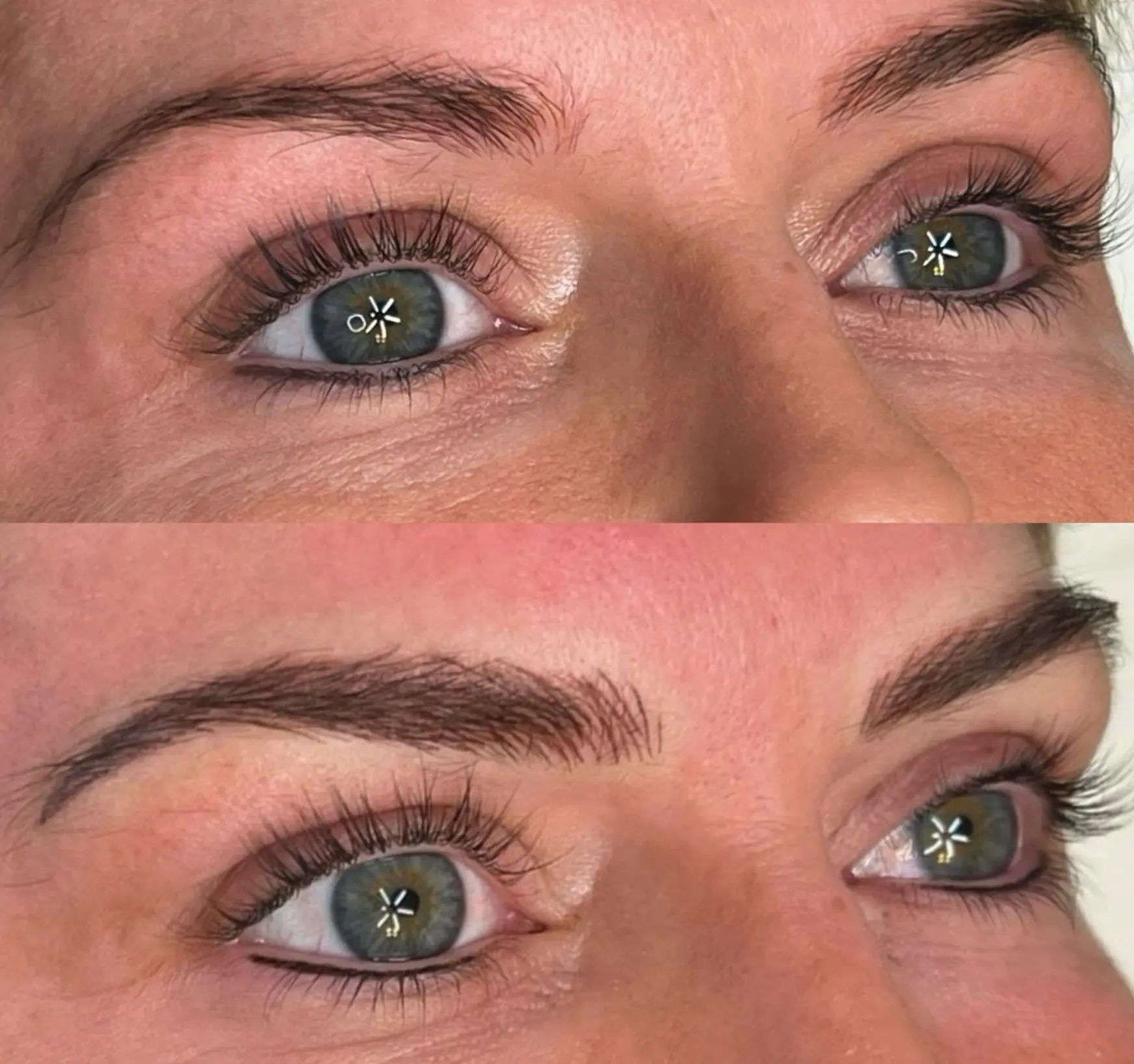 Why does my cosmetic tattoo hurt after 5 years?