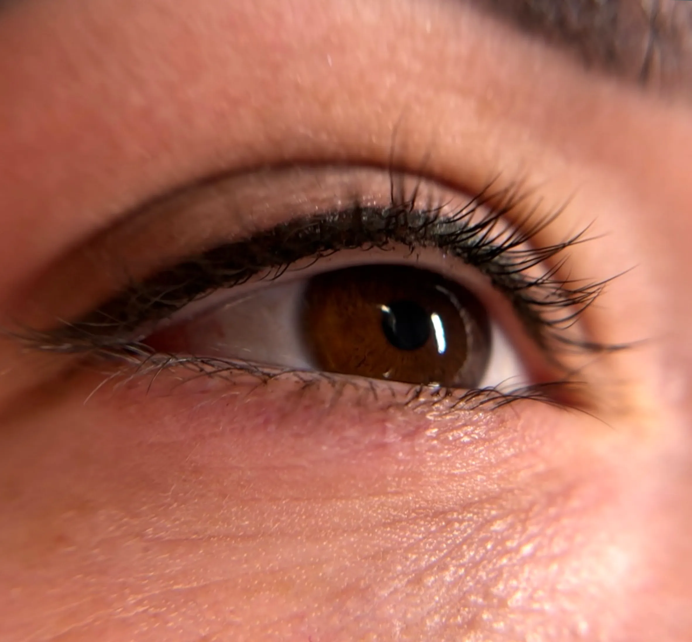 eyeliner tattoo lash loss