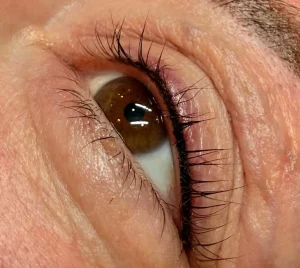 can eyelashes fall out