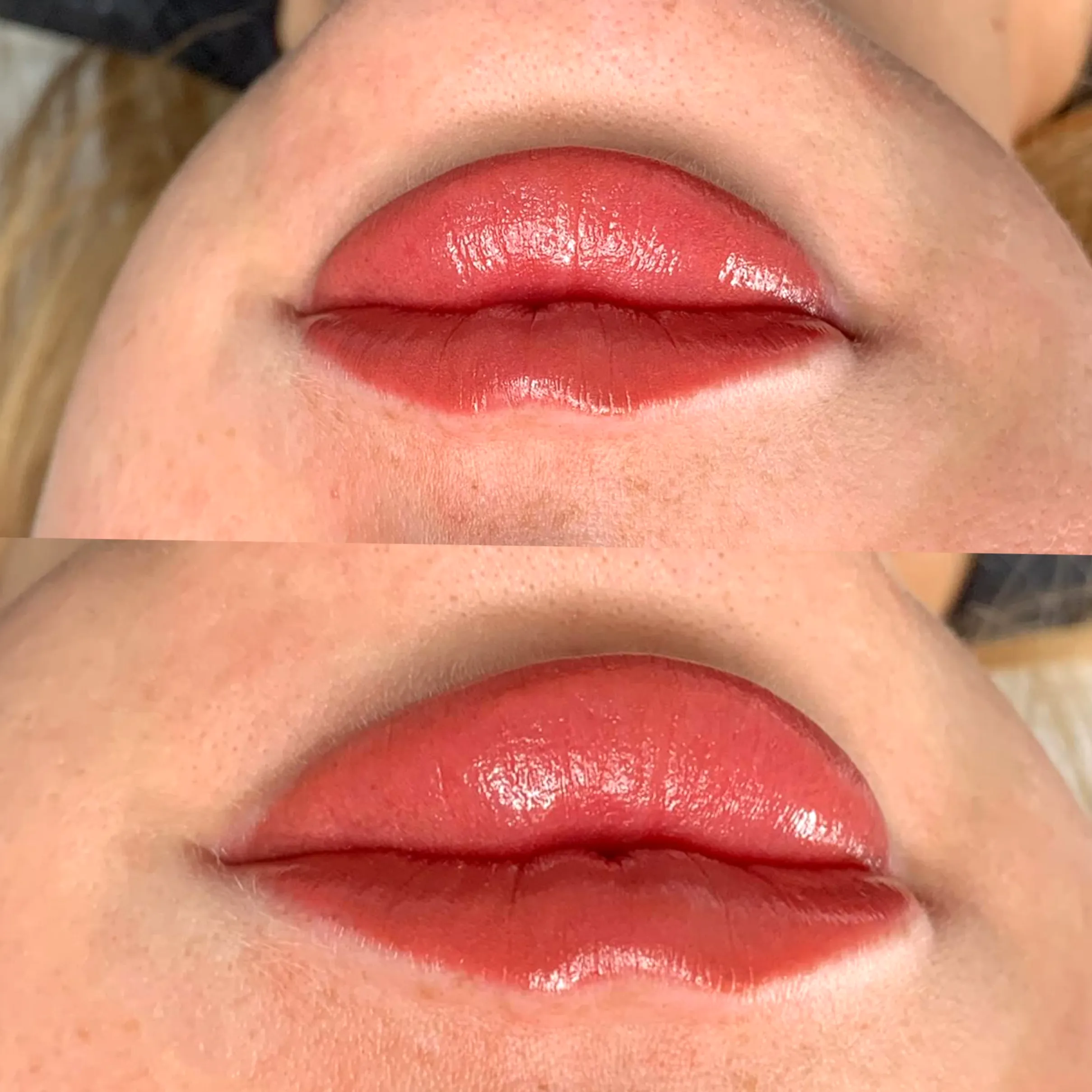 lip blush healing Melbourne